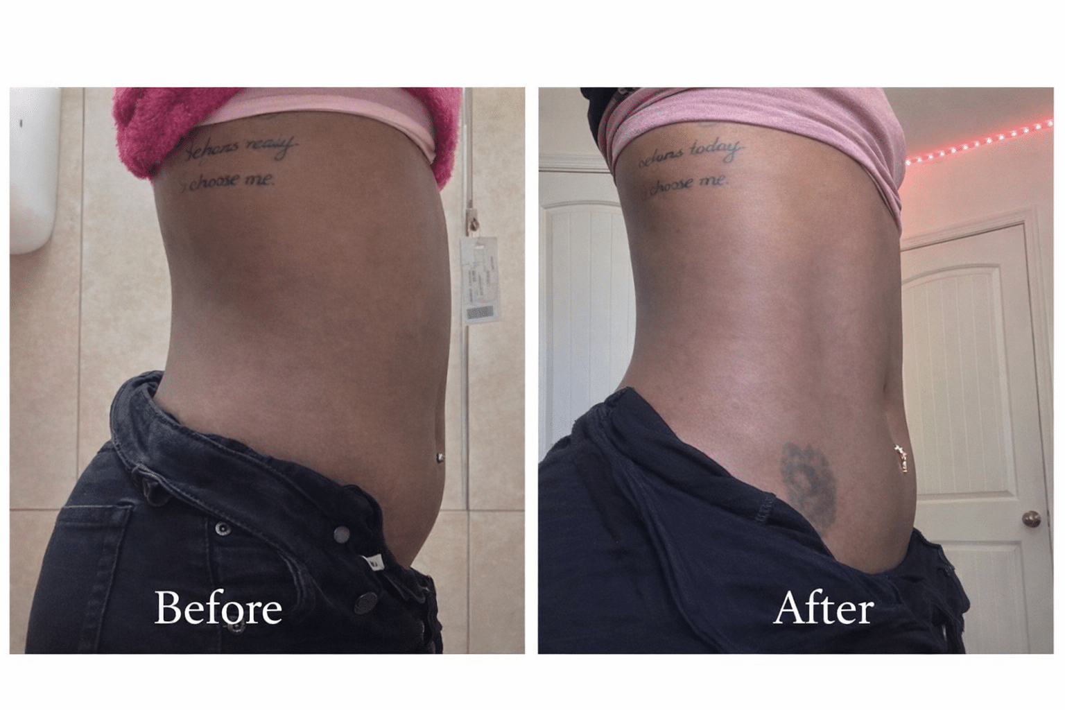 Before and After Image: Prime Body Scupting  - right-side